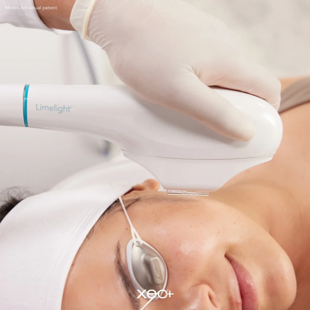 Limelight IPL in Richmond, KY