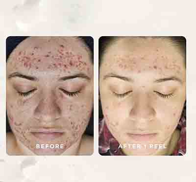 - The Skin Suite